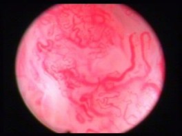 Hypoxia, Metabolism and Inflammatory arthritis Paragraph Pic